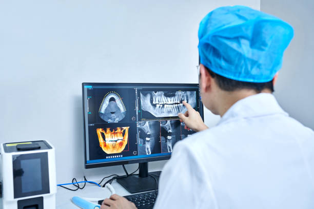 Best Emergency Dentist for Lost Fillings or Crowns in Rosedale, CA